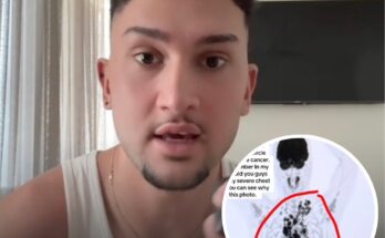 Man who was diagnosed with stage 4 cancer at 21 warns others about ignoring these common symptoms