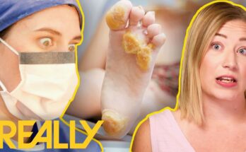 Ultra-Rare Condition With No Cure Treated With Revolutionary New Surgery | My Feet Are Killing Me