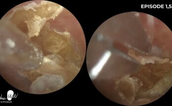 All About Itchy Ears: Why Do They Itch and How Do You Stop It?