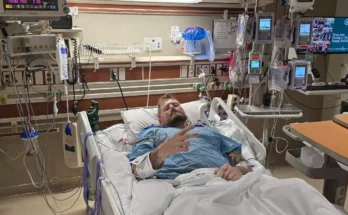 Man who burnt thumb while cooking shocked to wake up and find both his legs needed to be amputated